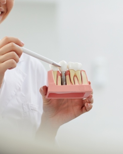 Dentist holding and pointing to dental implant model