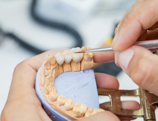 Close up of dental bridge being made in dental lab