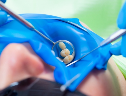 Dental mirror showing teeth on blue surface